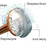 how does an airbag work